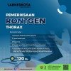 Pemeriksaan RONTGEN THORAX